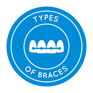 Types of braces Dr. Nick Karaiskos Orthodontist in Ottawa Manotick, ON